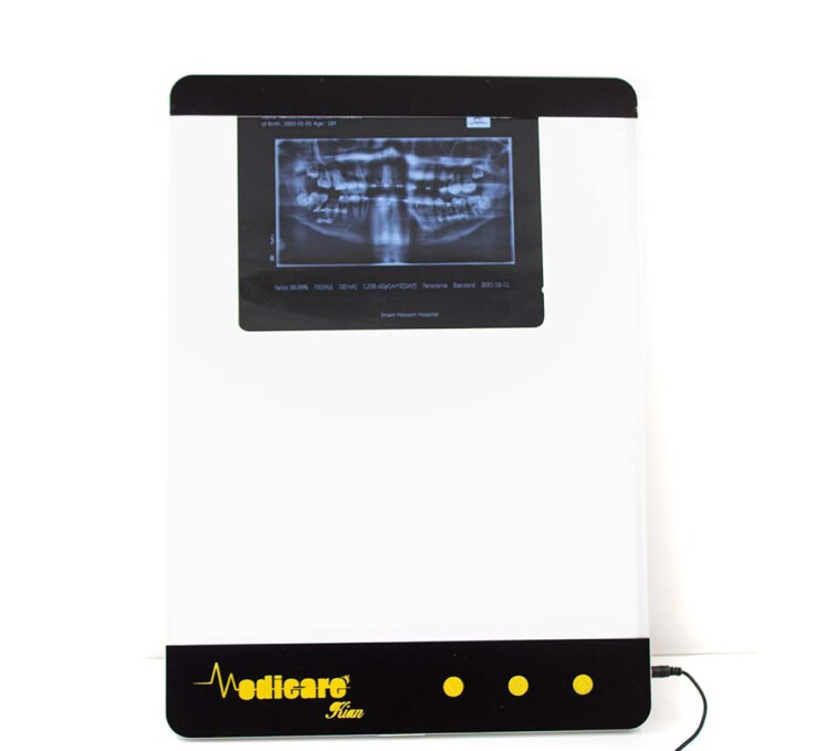 قیمت نگاتوسکوپ رادیولوژی LED تک خانه مدیکر 6163